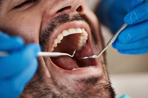 Best Emergency Dental Care for Trauma or Injury in Casselton, ND